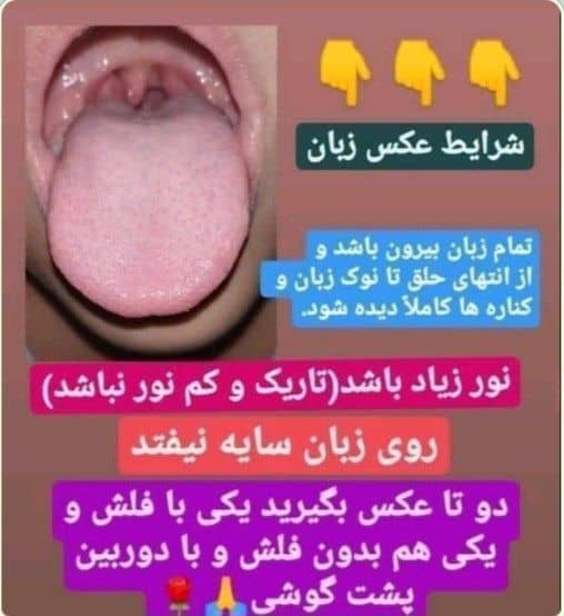 طب سنتی از طریق مزاج شناسی و زبان شناسی در کرمانشاه