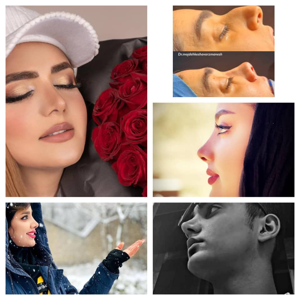 بهترین دکتر متخصص گوش حلق بینی و جراحی زیبایی صورت در مشهد