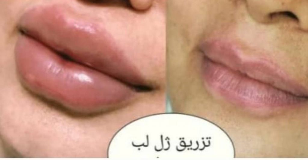 بهترین مرکز تزریق ژل و بوتاکس و کوکتل و ویتامین سی در اصفهان