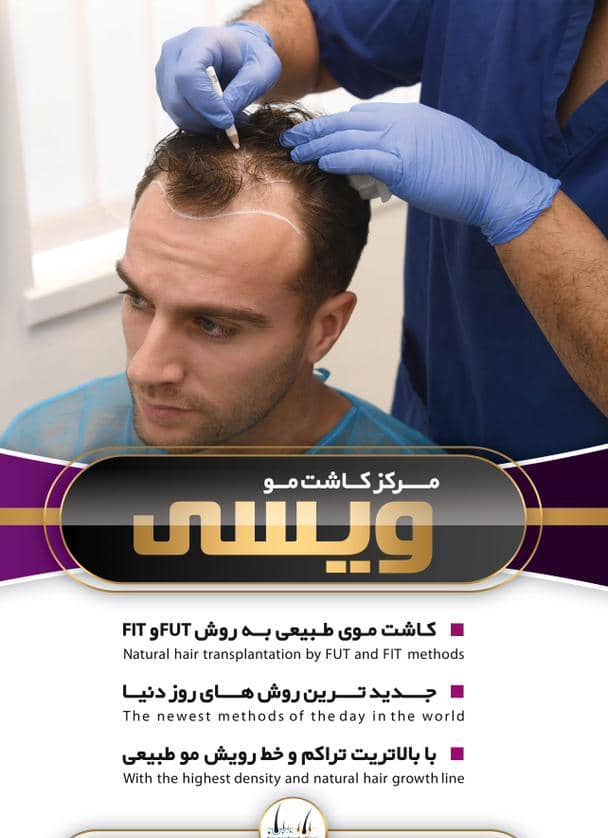 بهترین کلینیک کاشت مو ویسی در کرمانشاه