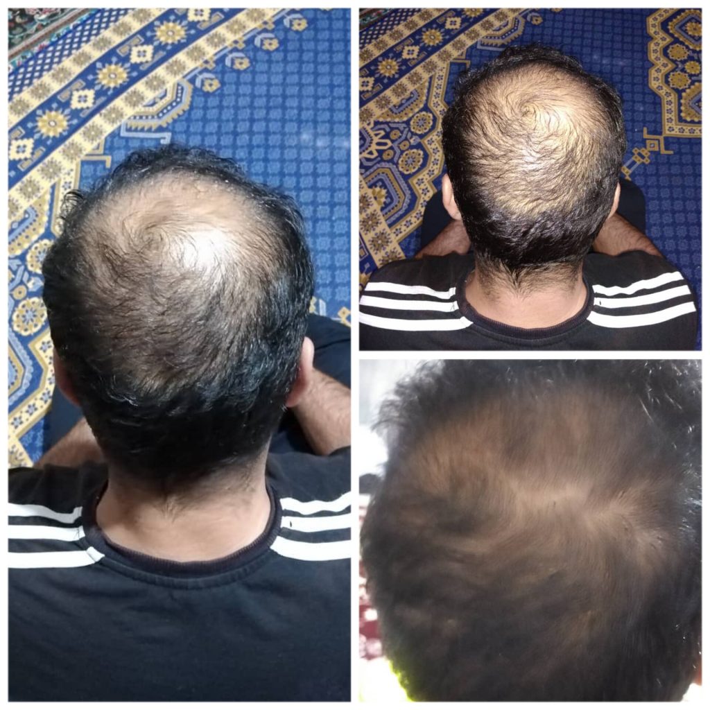کار آفرین و مشاور پوست و مو با محصولات کاملا گیاهی و ارگانیک در شیراز