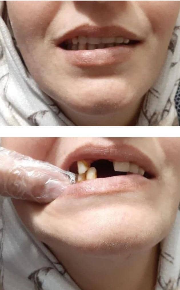 بهترین کلینیک حرفه ای دندانسازی و ساخت و تعمیر پروتزهای دندان حسینی خواه در اسلامشهر